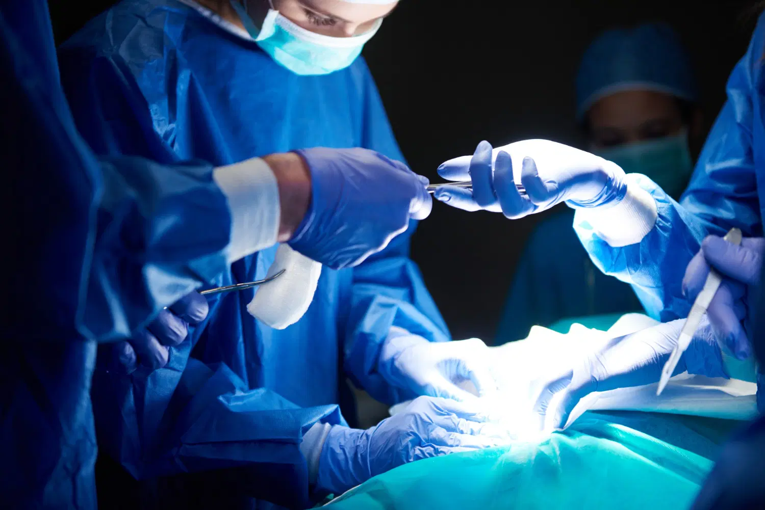 Laparoscopic Fundoplication Surgery