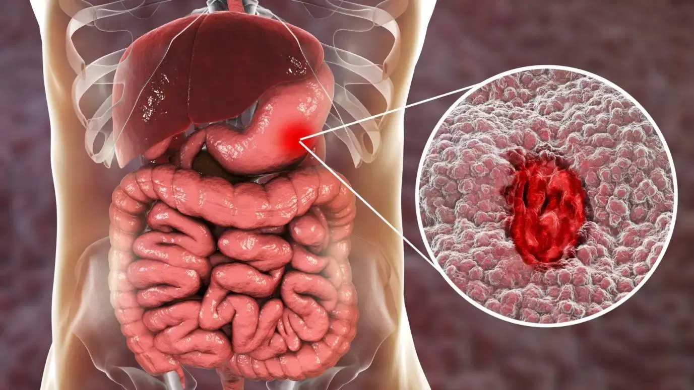 Gastrointestinal Oncology Surgery