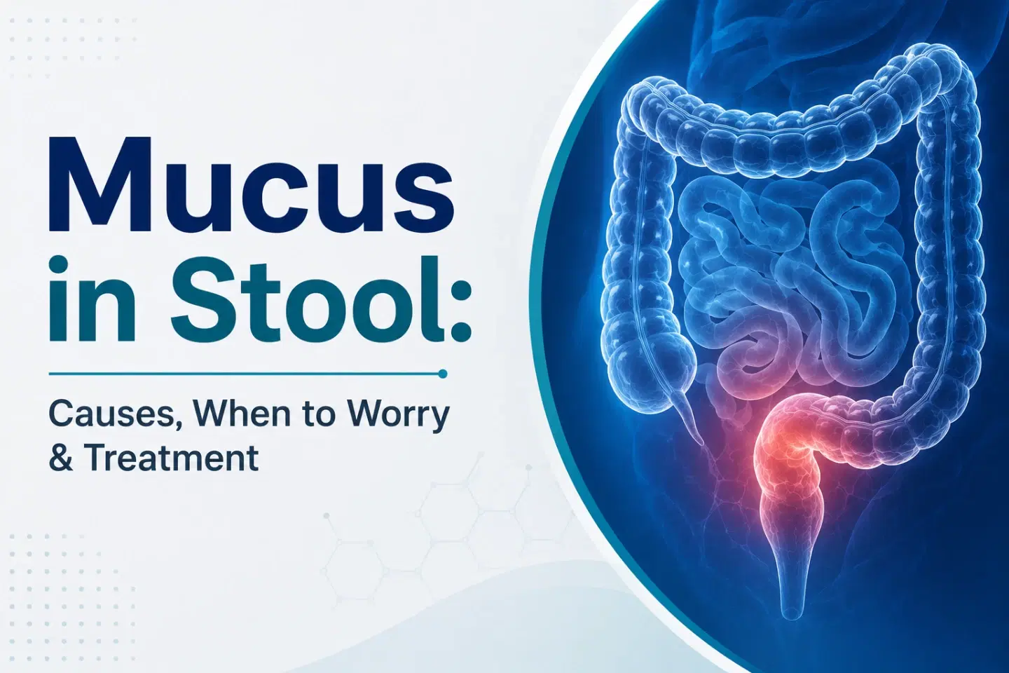 Mucus in Stool: Causes, When to Worry & Treatment