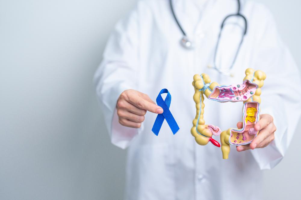 The Importance of Colon Cancer Screening and Prevention: Your Comprehensive Guide.