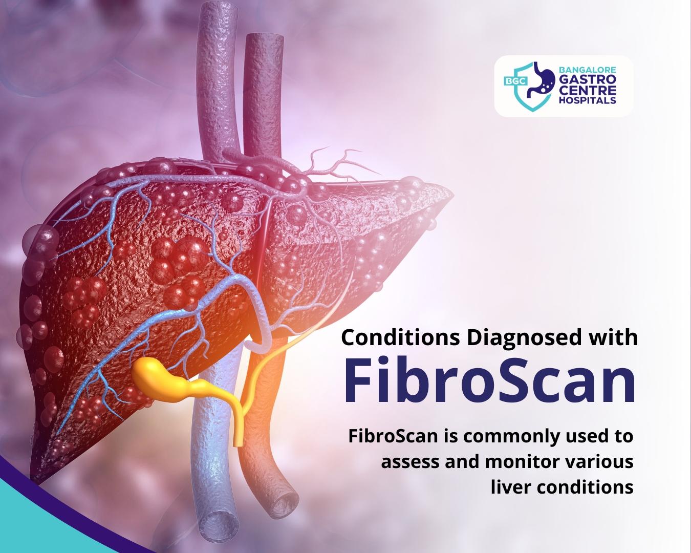 Welcome to Bangalore Gastro Centre Your Trusted Destination for FibroScan Procedure